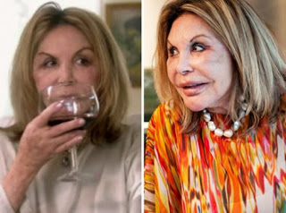 I'm actually waiting for a new shipment of this stuff so no picture. Instead I'll give you Else Patton from RHOMiami because her face looks like mine feels in winter.